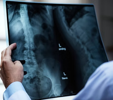 X-ray